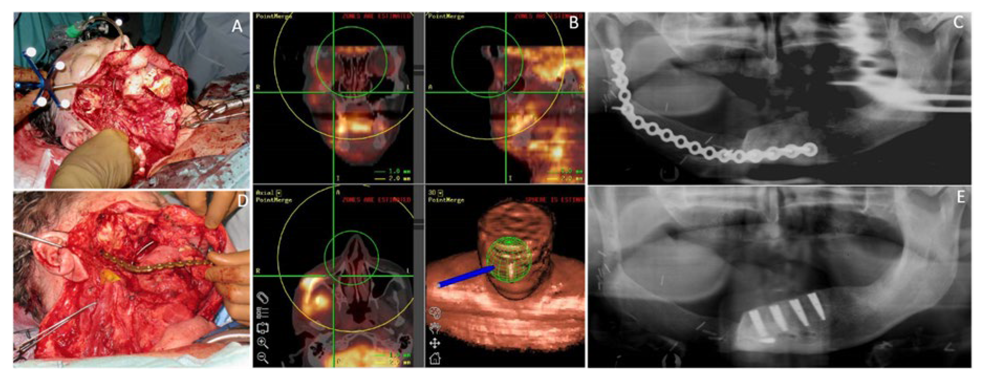 Cancers 12 03198 g005 Cancers 12 03198 g005