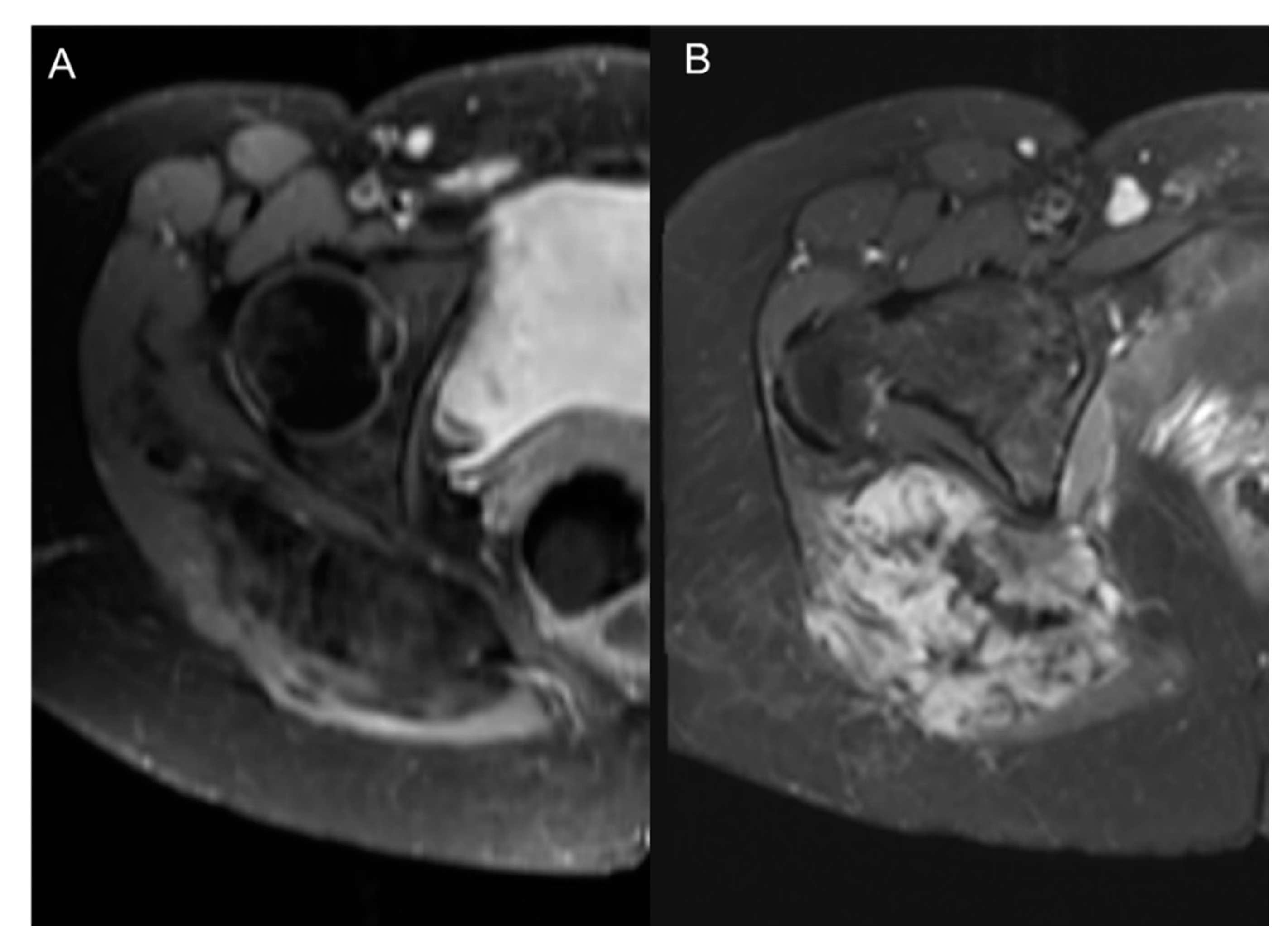 Cancers 12 03239 g004