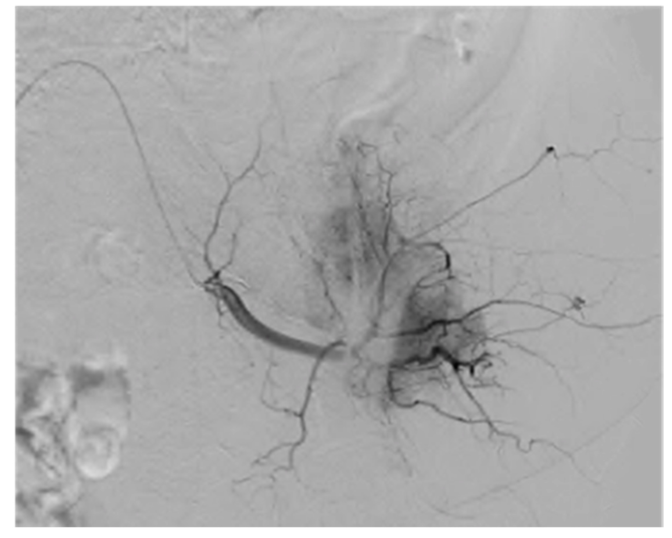 Cancers 12 03239 g006