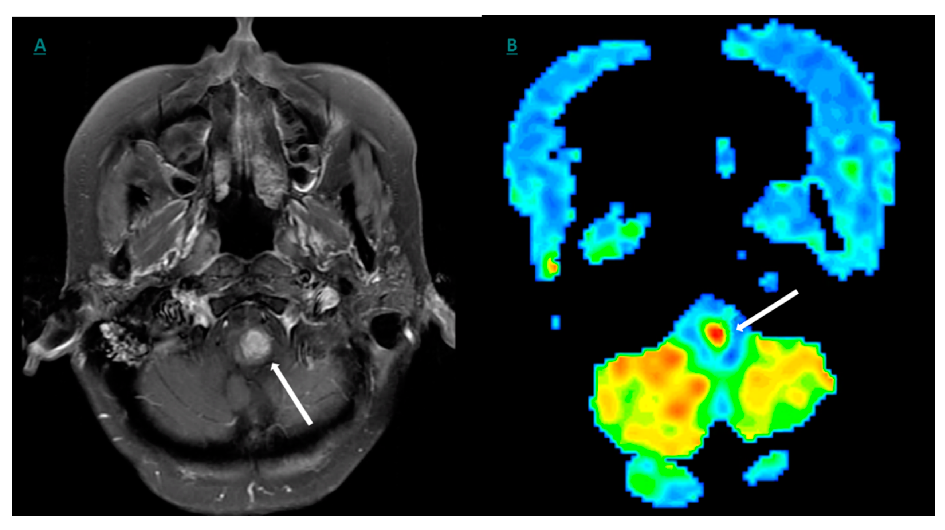 Cancers 12 03239 g007