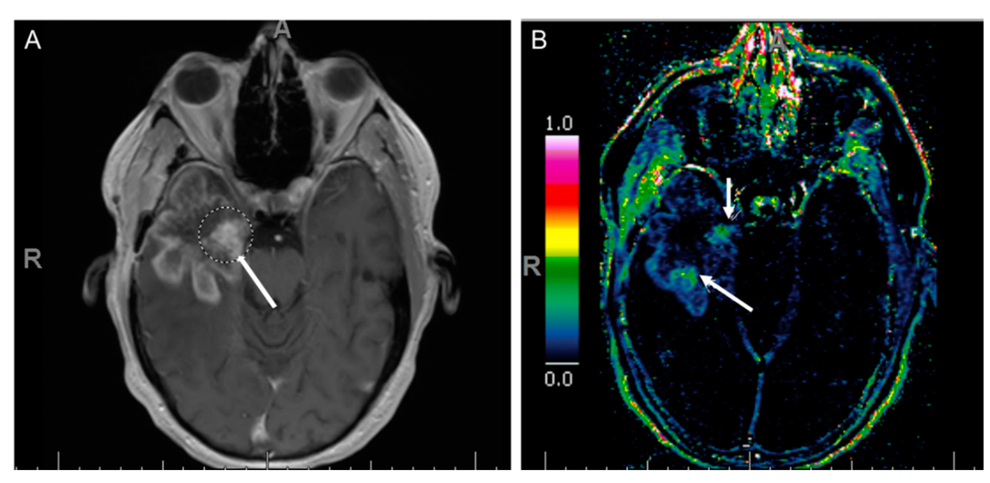 Cancers 12 03239 g008