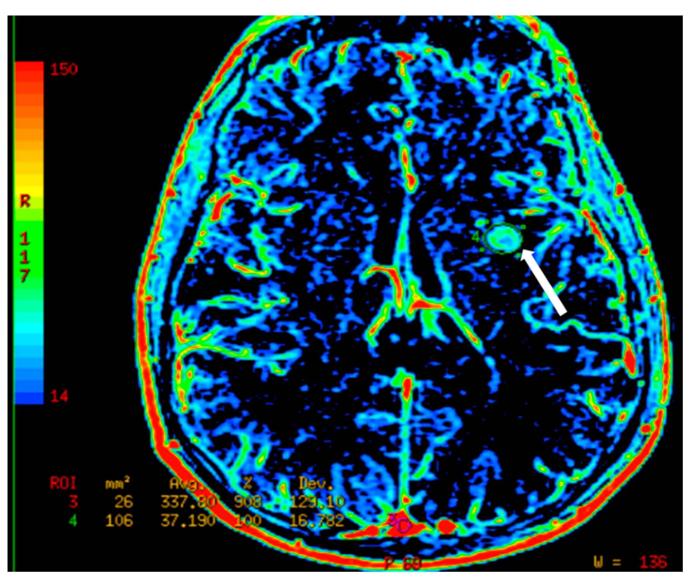 Cancers 12 03239 g009