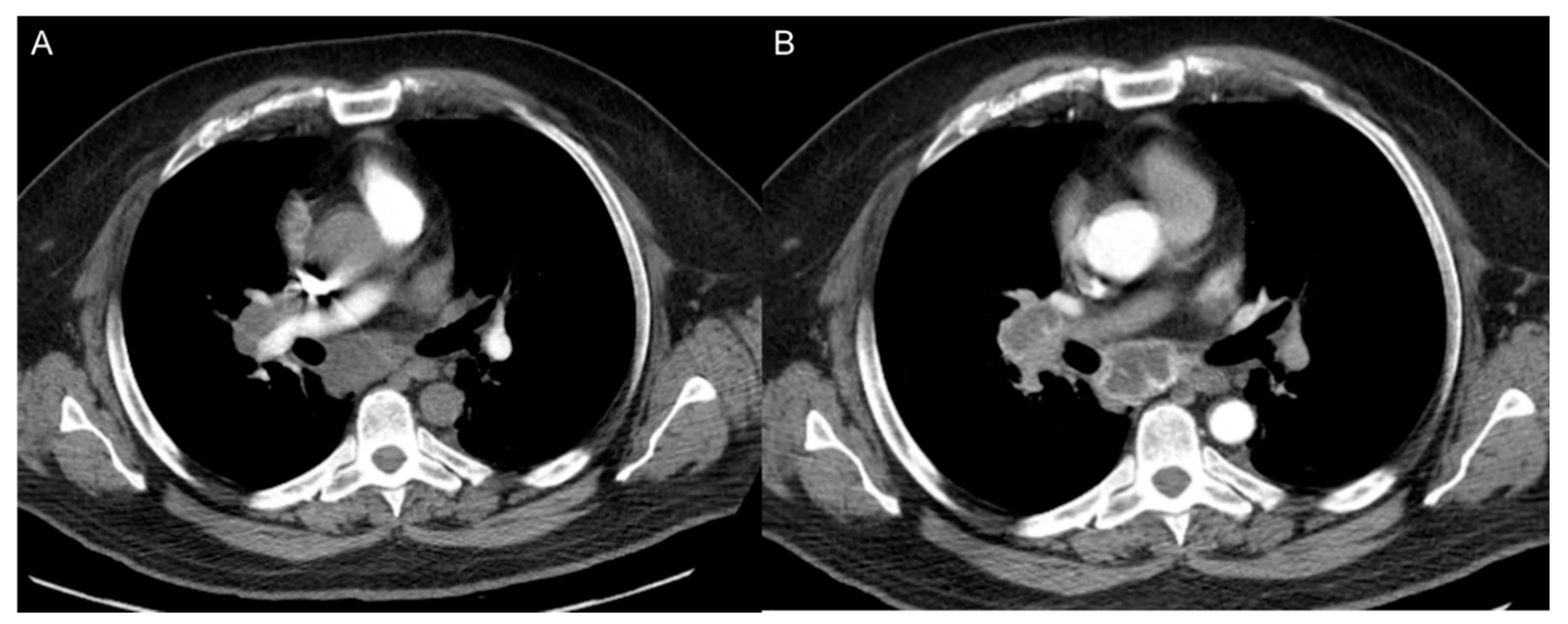 Cancers 12 03239 g010