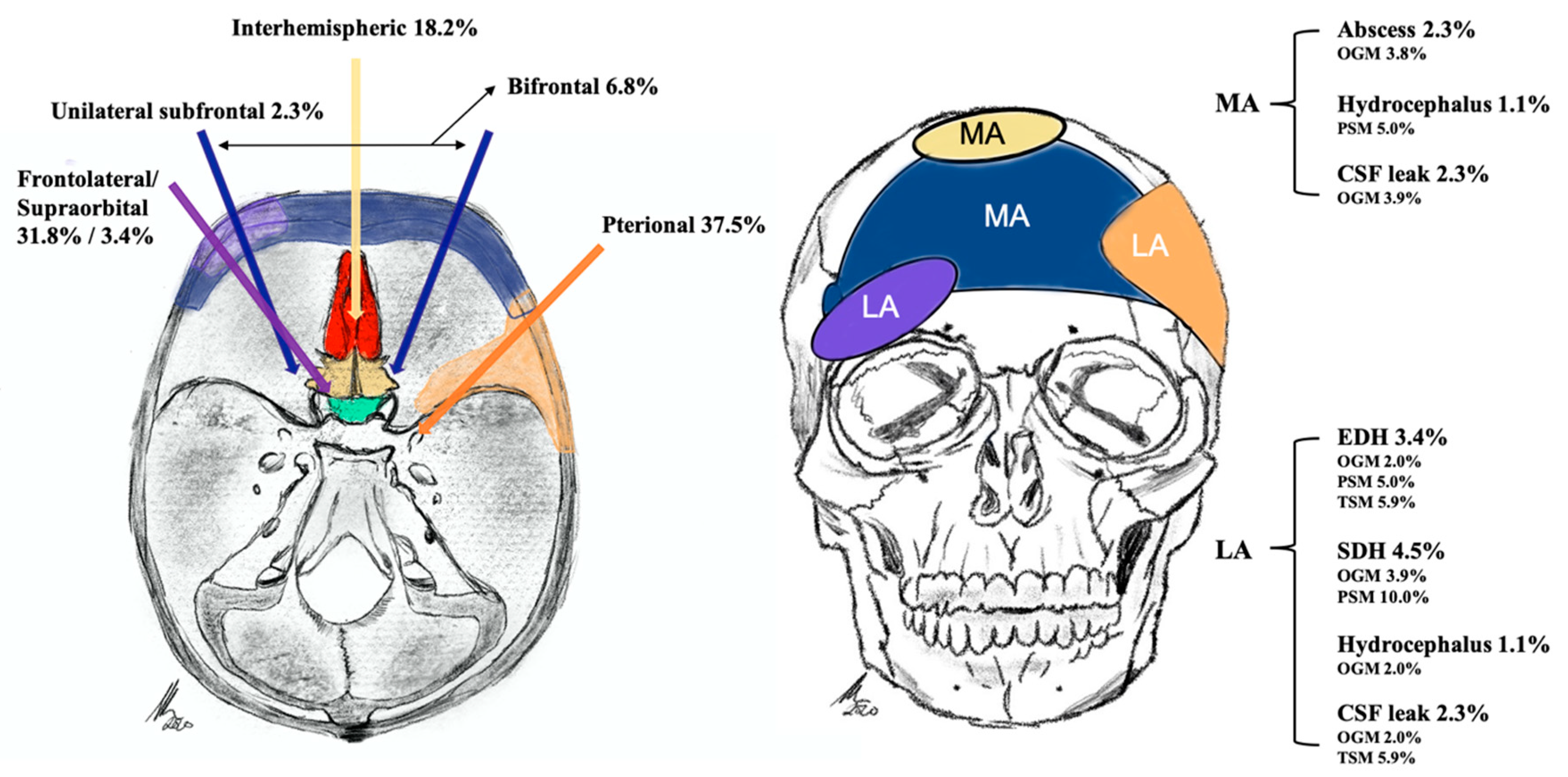 Advances in Multidisciplinary Management of Skull Base