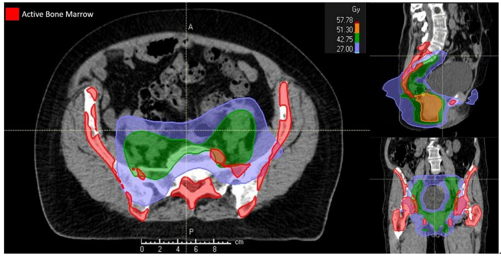 Cancers 12 03306 g002
