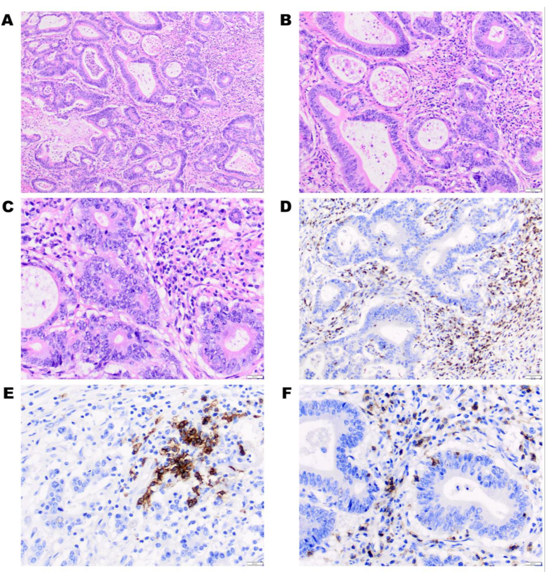 Cancers 12 03311 g012 Cancers 12 03311 g012