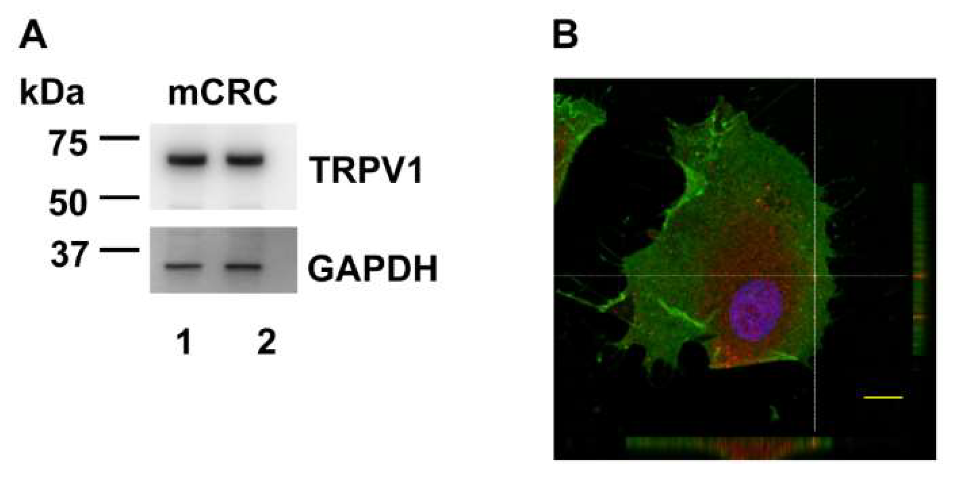Cancers 12 03338 g008