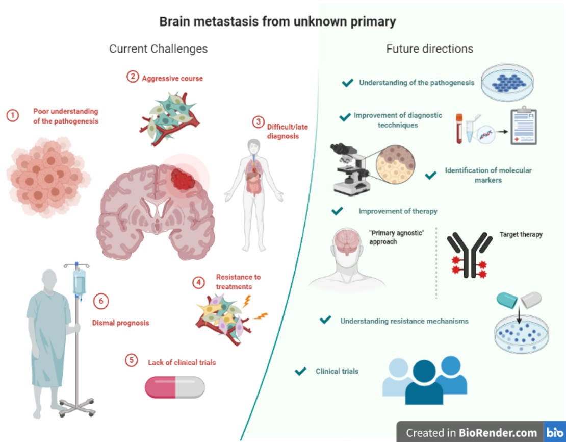 Cancers | Free Full-Text | Brain Metastasis From Unknown Primary Tumour:  Moving From Old Retrospective Studies To Clinical Trials On Targeted Agents