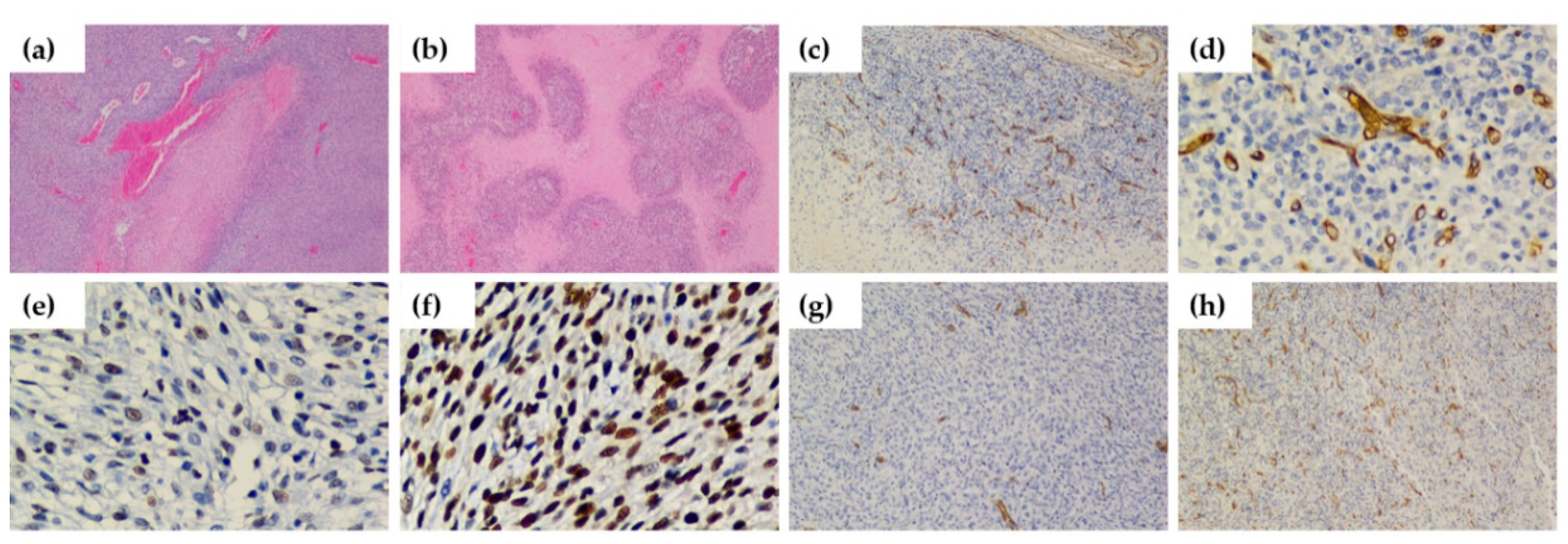 Cancers 12 03417 g006 Cancers 12 03417 g006