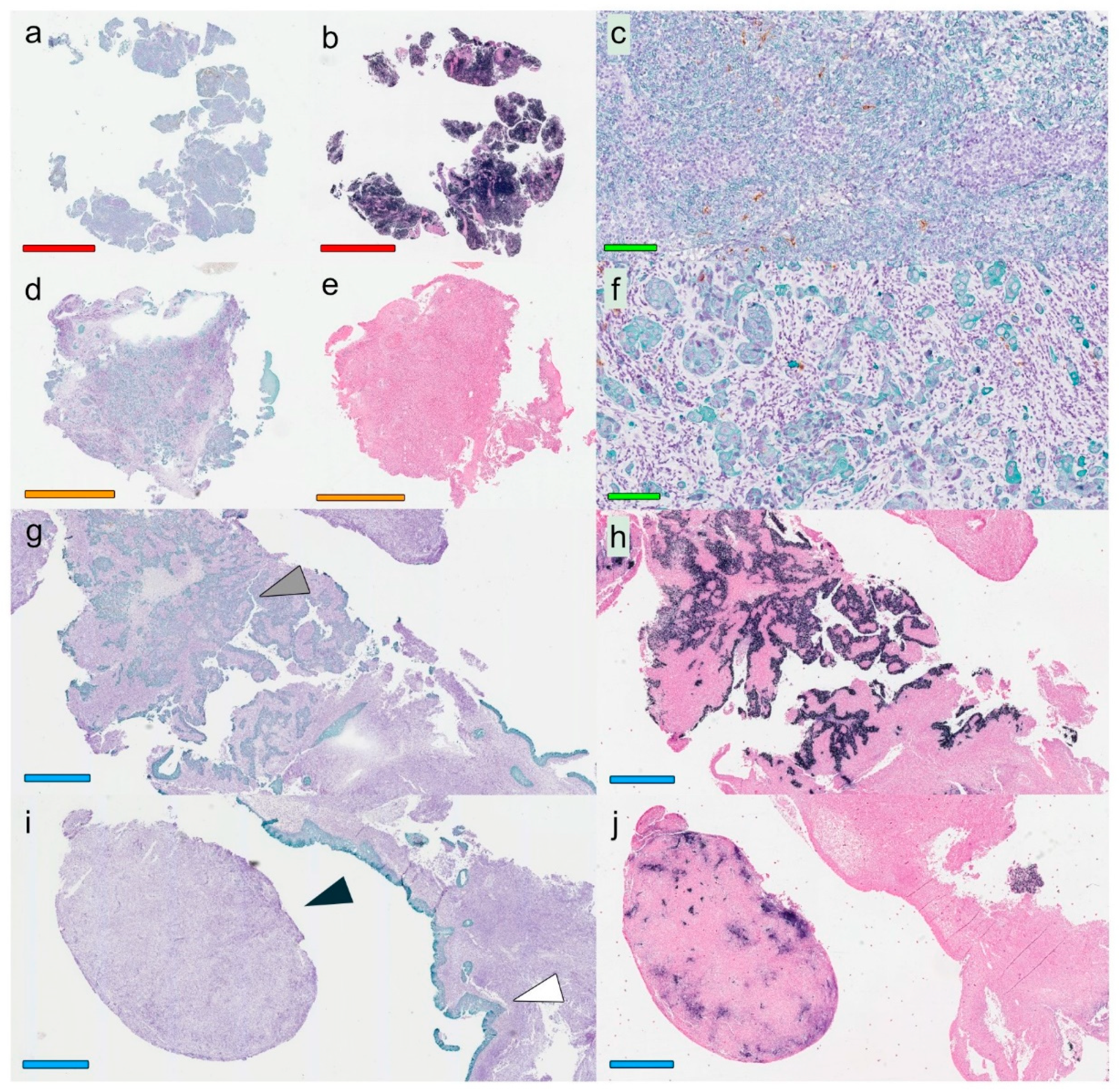 Cancers 12 03428 g001