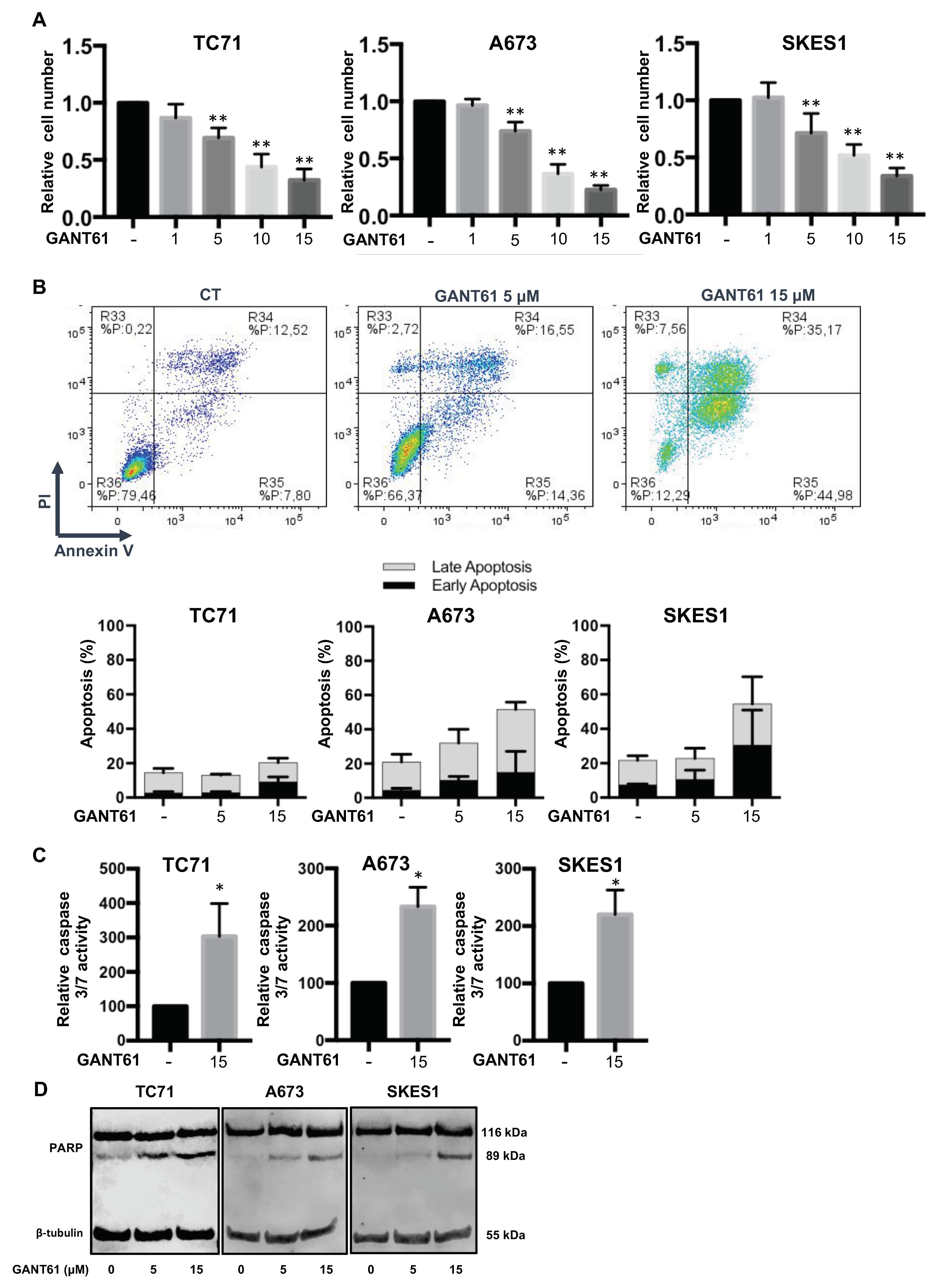 Cancers | Free Full-Text | Sonic Hedgehog Signature in Pediatric Primary  Bone Tumors: Effects of the GLI Antagonist GANT61 on Ewing's Sarcoma Tumor  Growth