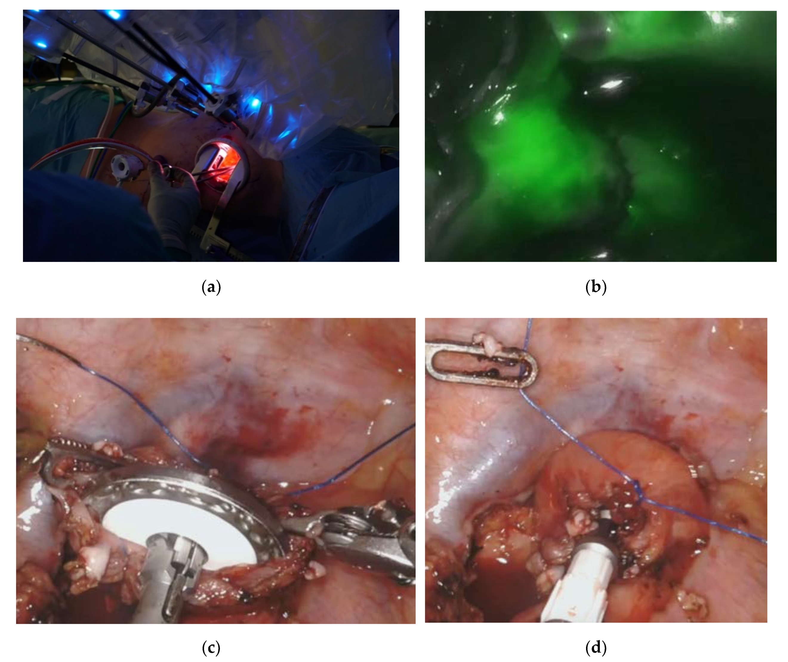 Cancers 12 03474 g003 Cancers 12 03474 g003