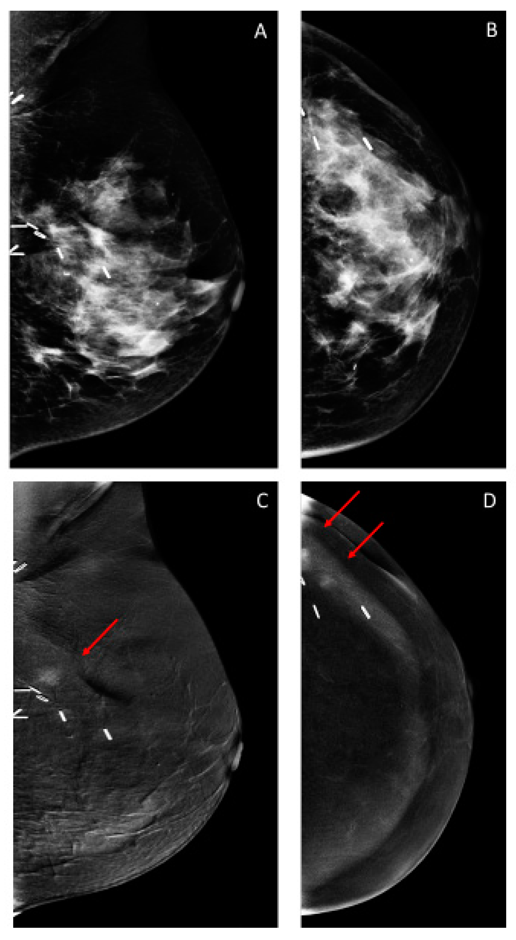 Cancers 12 03495 g002