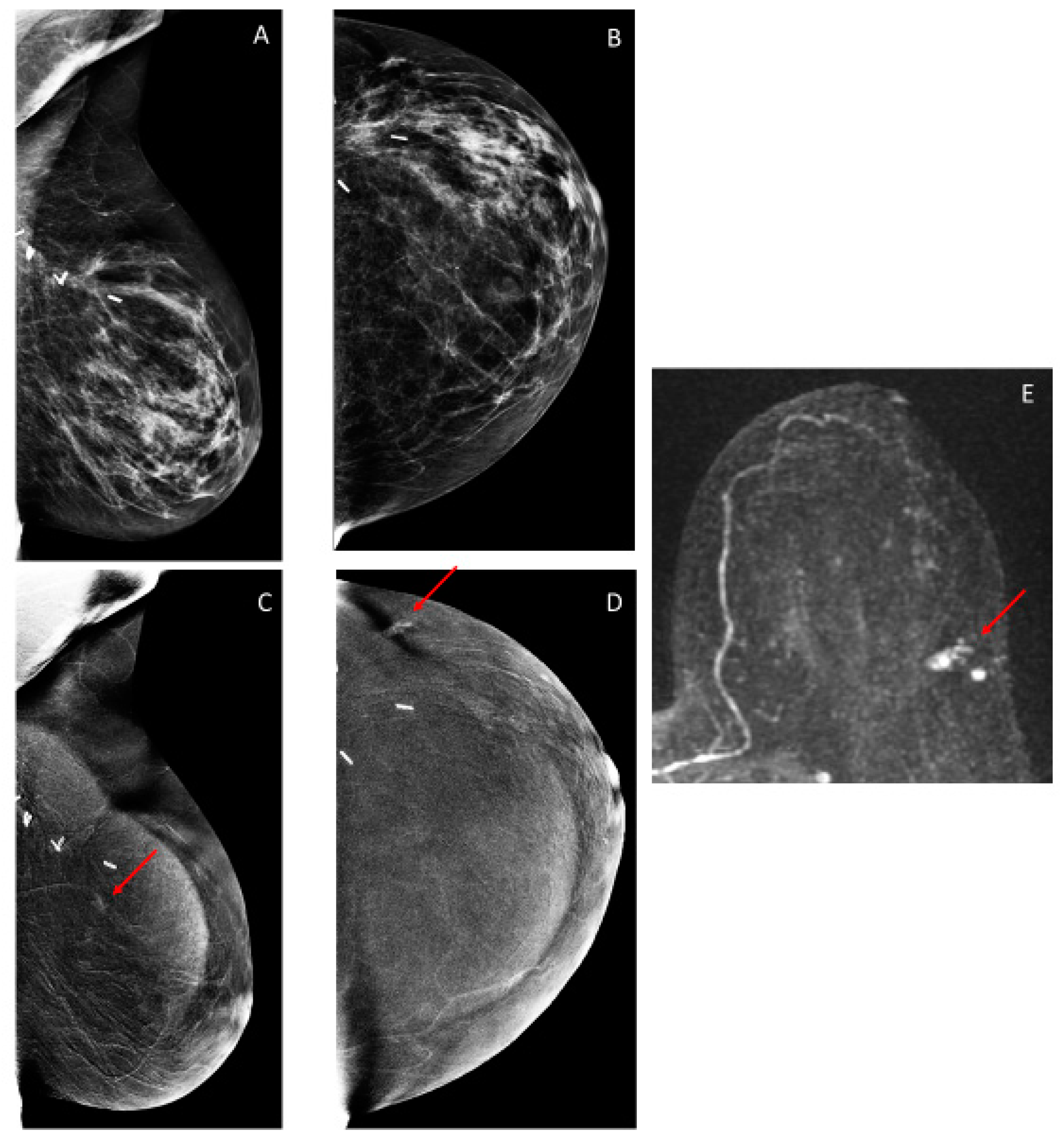 Cancers 12 03495 g003