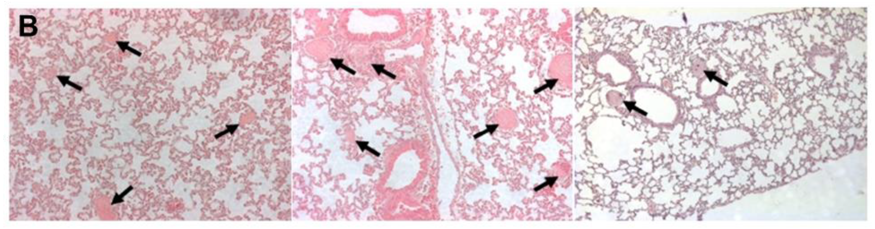 Cancers 12 03536 g002b