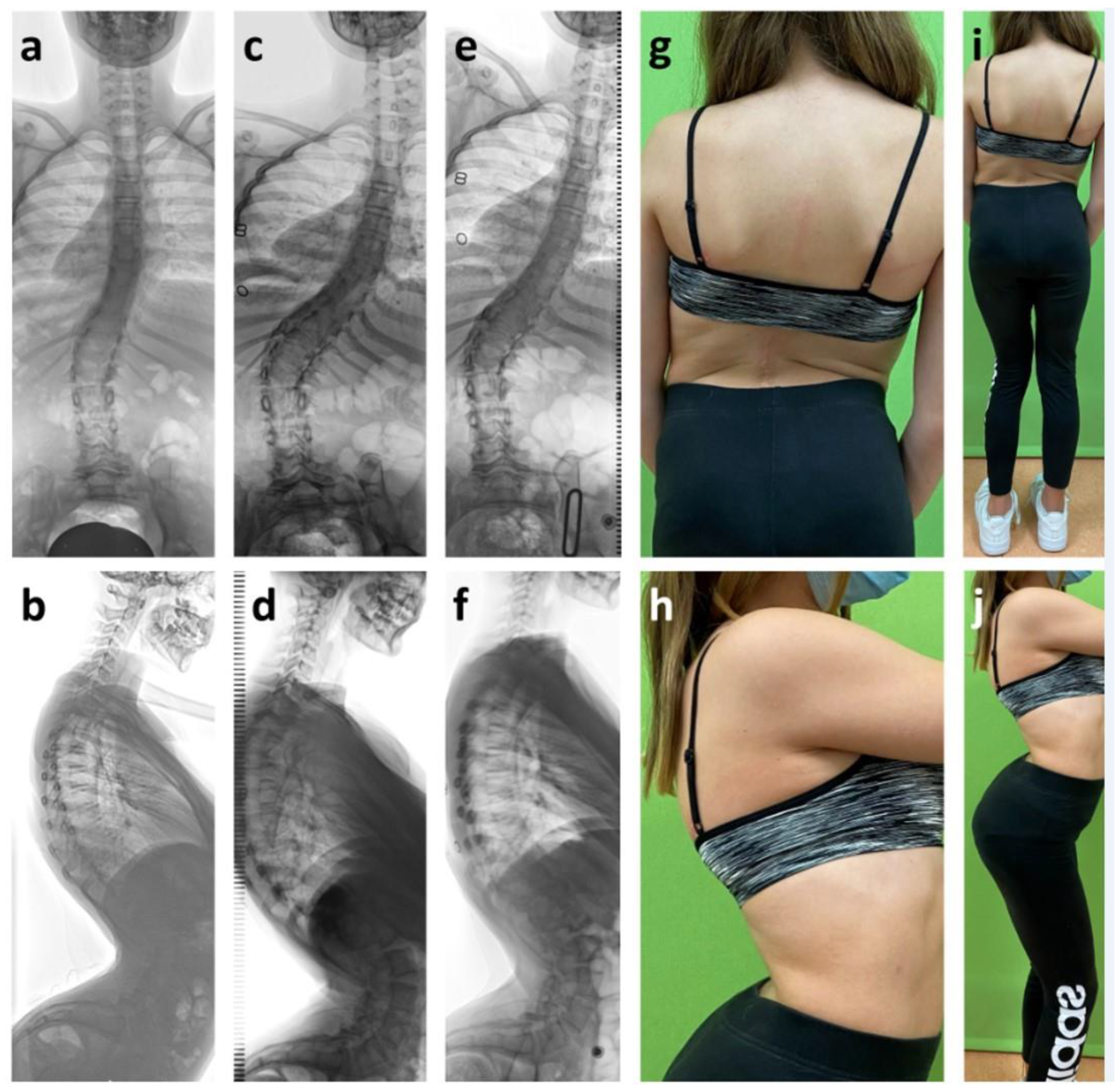 Cancers 12 03555 g006