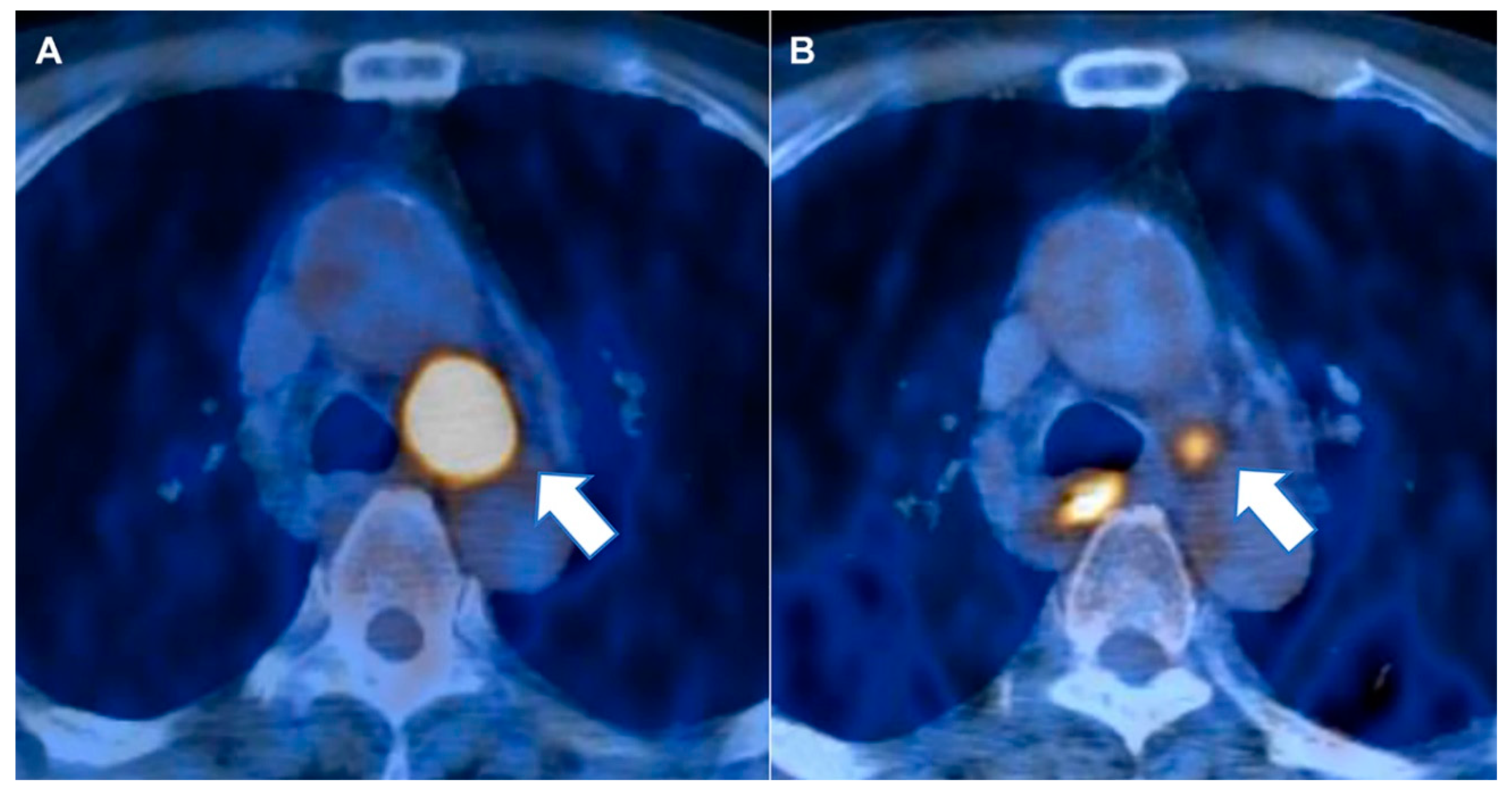 Cancers 12 03564 g003