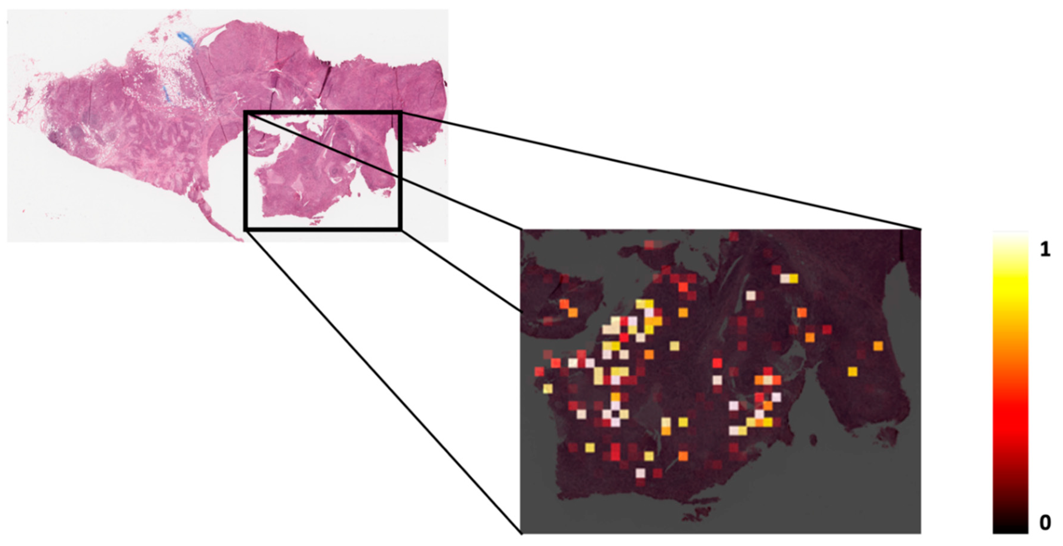 Cancers 12 03687 g002 Cancers 12 03687 g002