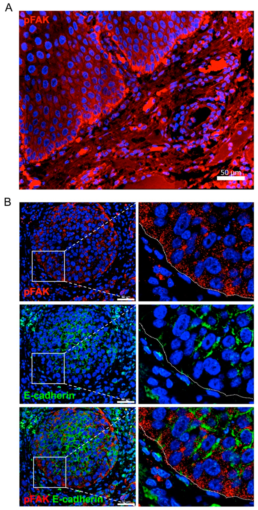 Cancers 12 03708 g009 Cancers 12 03708 g009