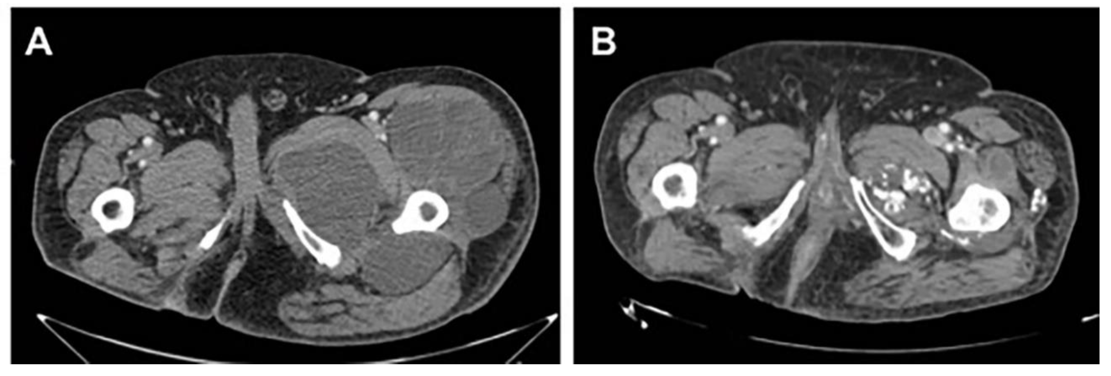 Cancers 12 03740 g002
