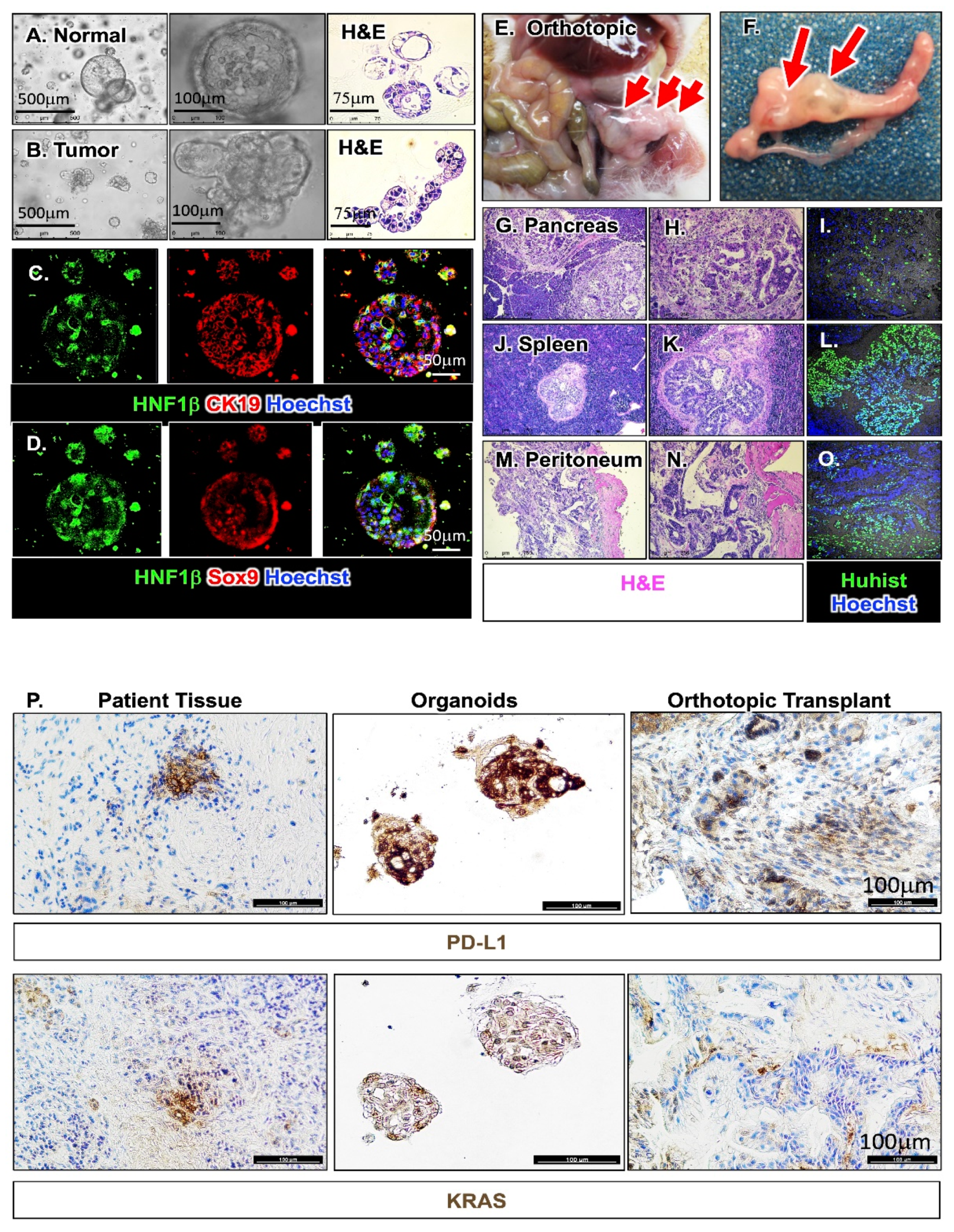 Cancers 12 03816 g005