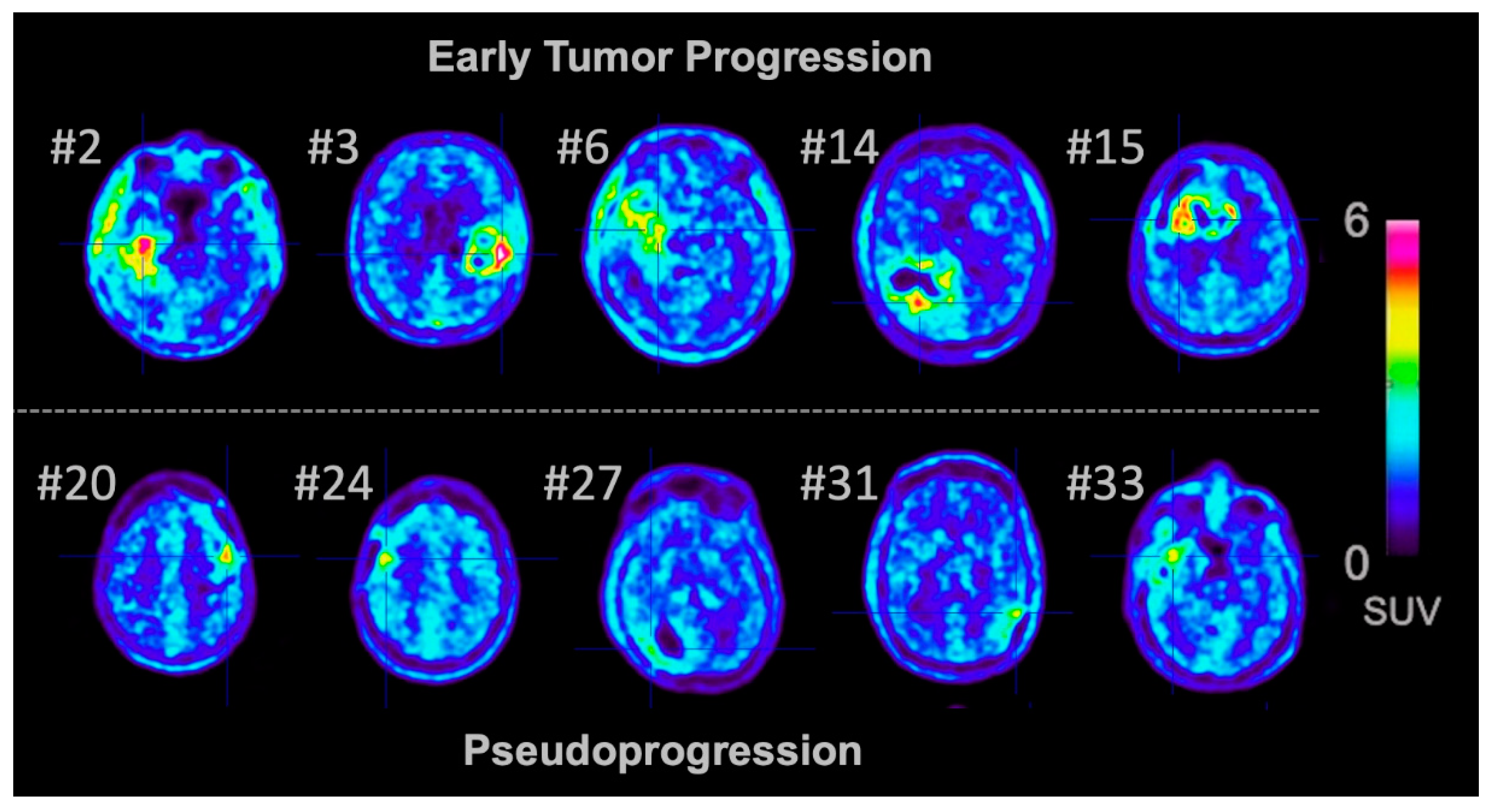 Cancers 12 03835 g002 Cancers 12 03835 g002