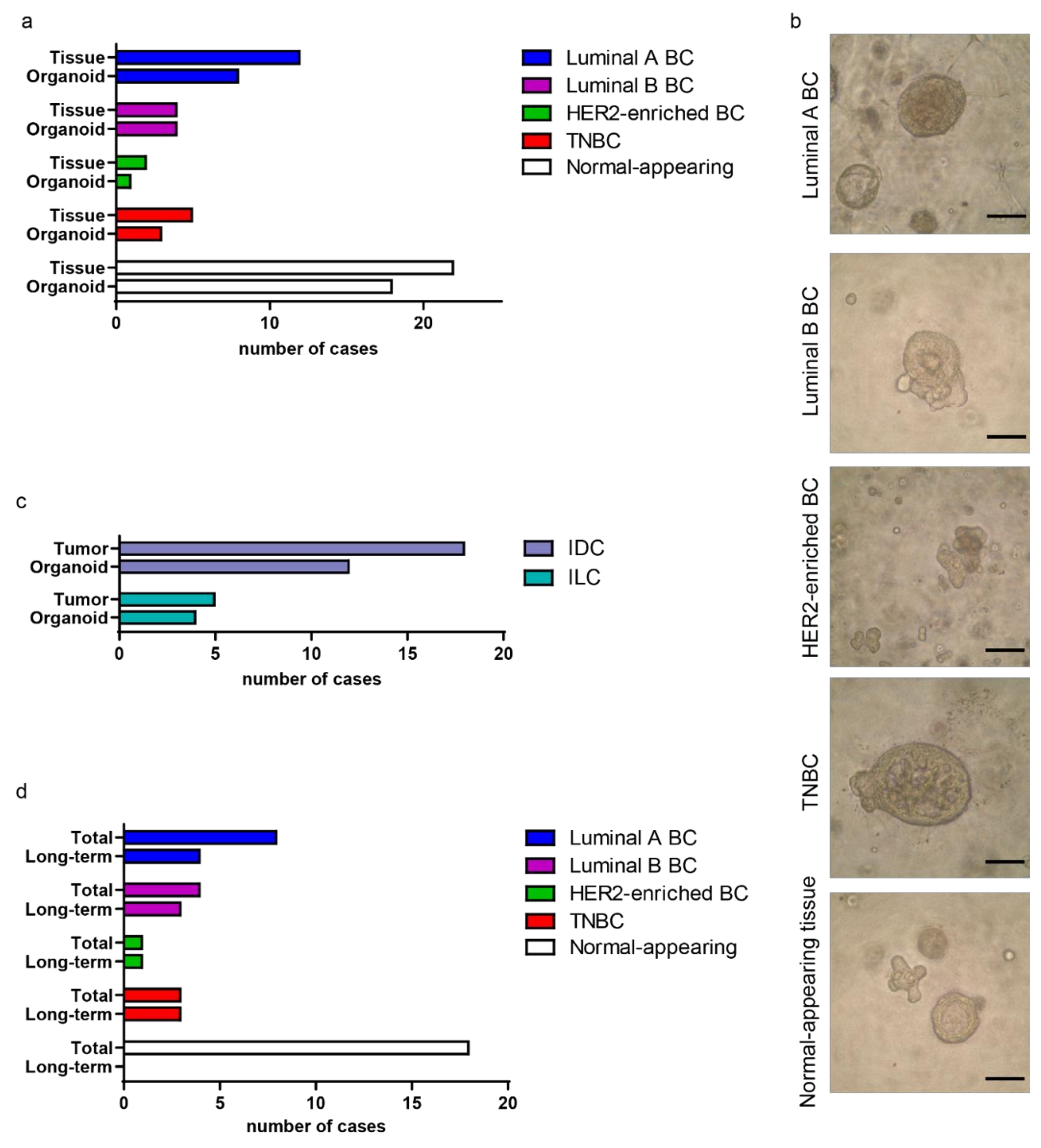 Cancers Free Full Text Breast Cancer Organoids Model Patient Specific Response To Drug Treatment Cancers Free Full Text Breast Cancer Organoids Model Patient Specific Response To Drug Treatment
