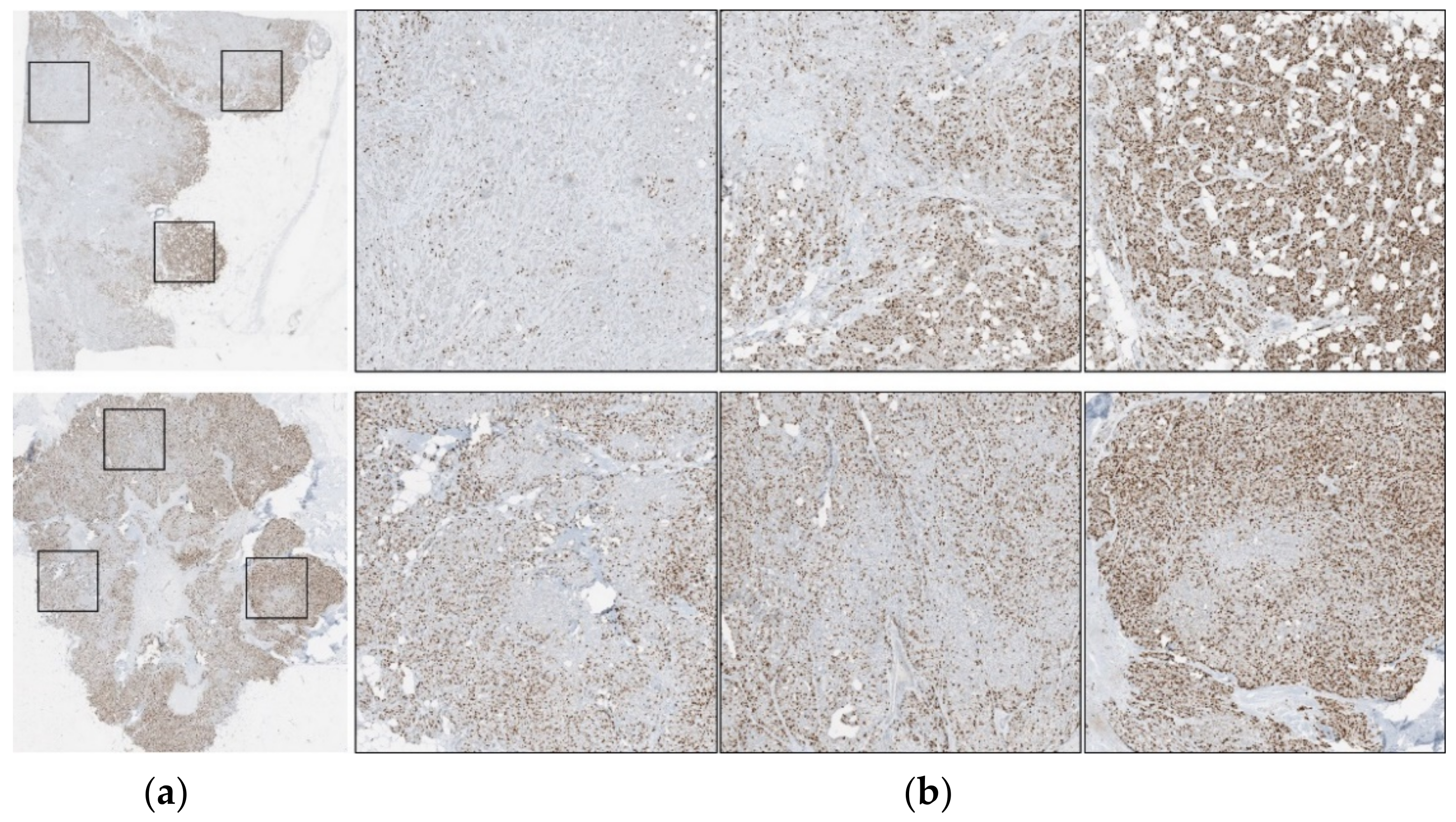 Cancers 13 00011 g003