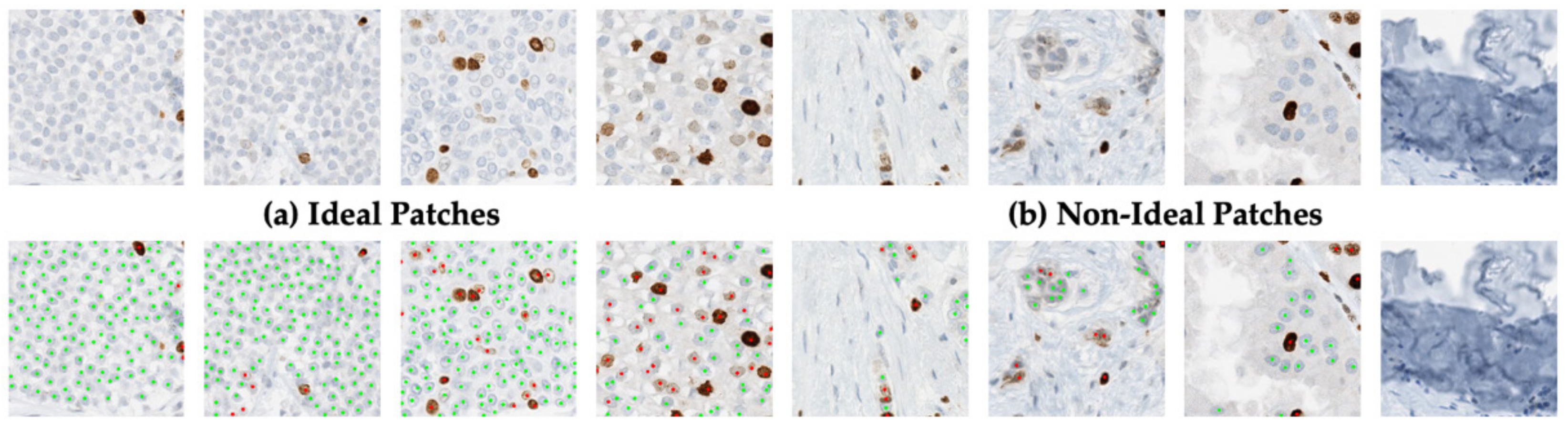 Cancers 13 00011 g007