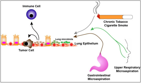 The Lung Microbiome: A Central Mediator of Host Inflammation