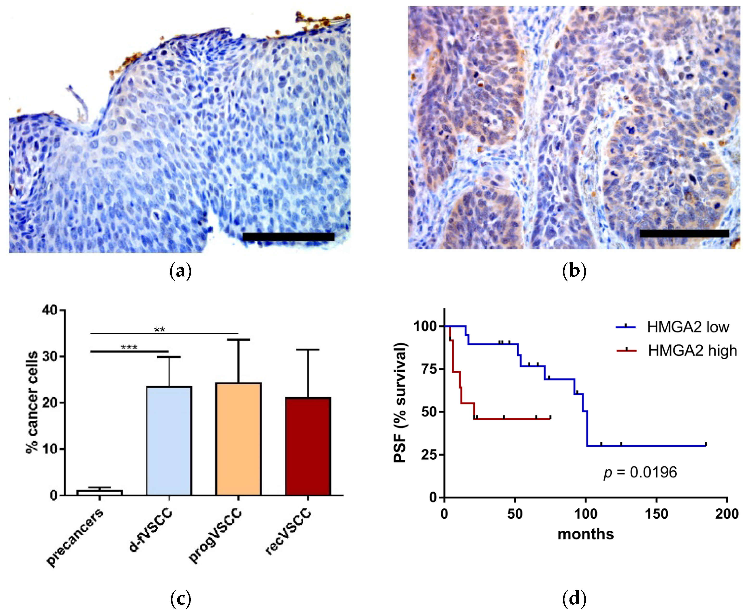 Cancers 13 00027 g002