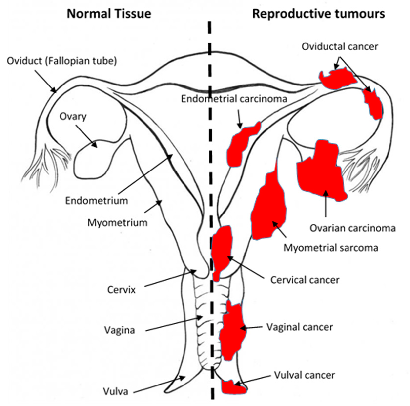 Cancers 13 00037 g002