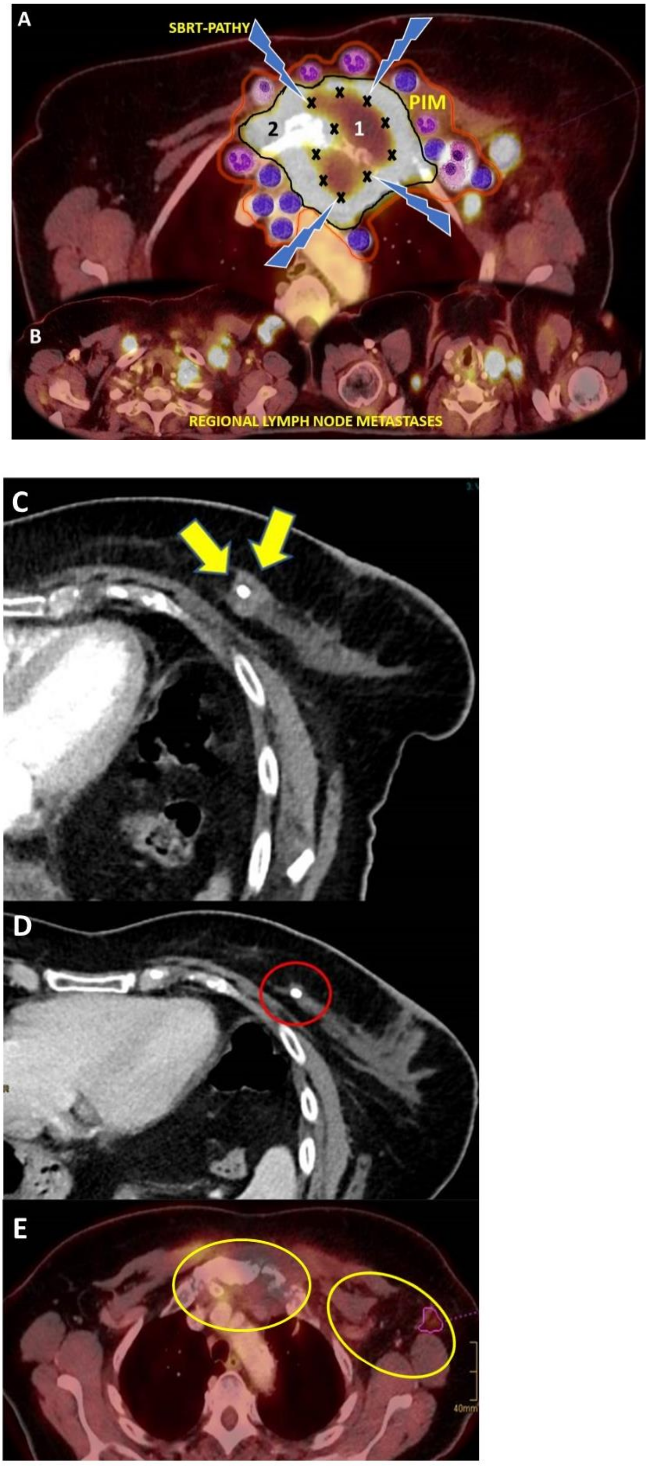 Cancers 13 00050 g001 Cancers 13 00050 g001