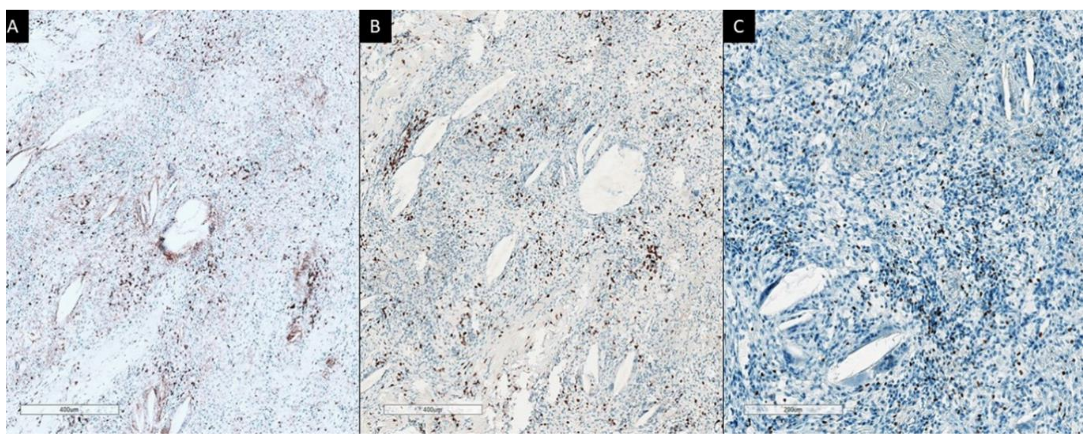 Cancers 13 00050 g002 Cancers 13 00050 g002