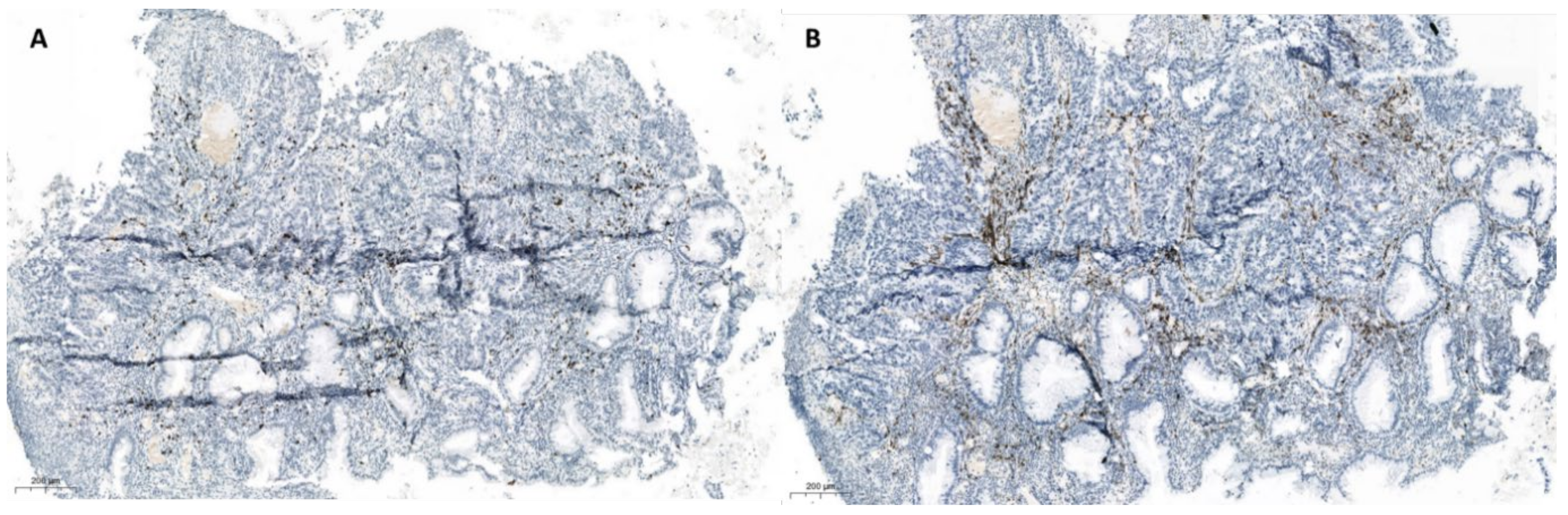 Cancers 13 00050 g003 Cancers 13 00050 g003