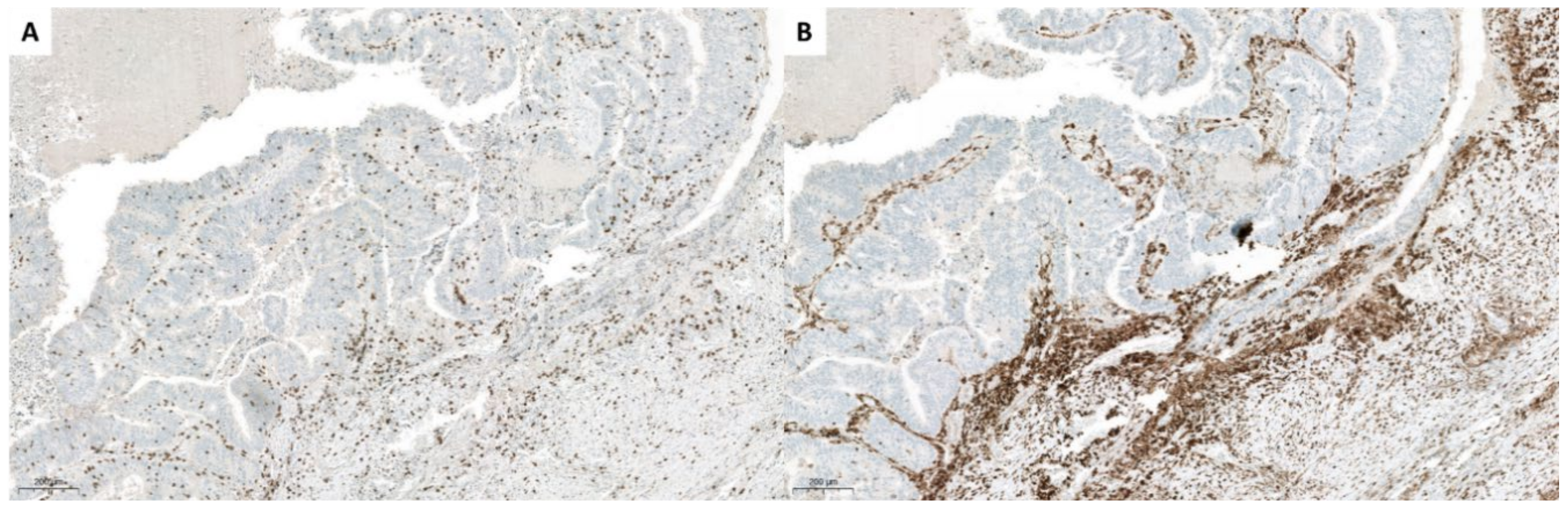 Cancers 13 00050 g005 Cancers 13 00050 g005