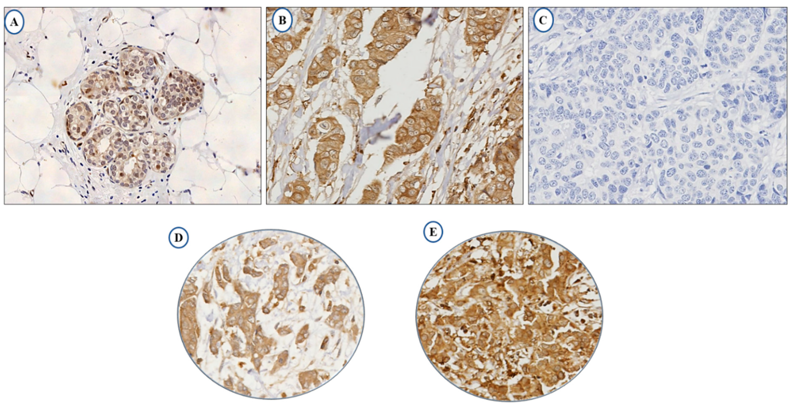 Cancers 13 00080 g001 Cancers 13 00080 g001