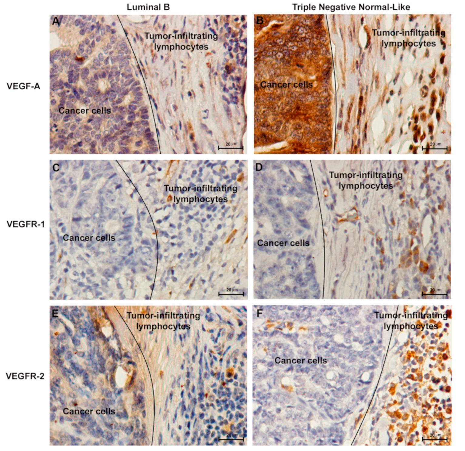 Cancers 13 00117 g003