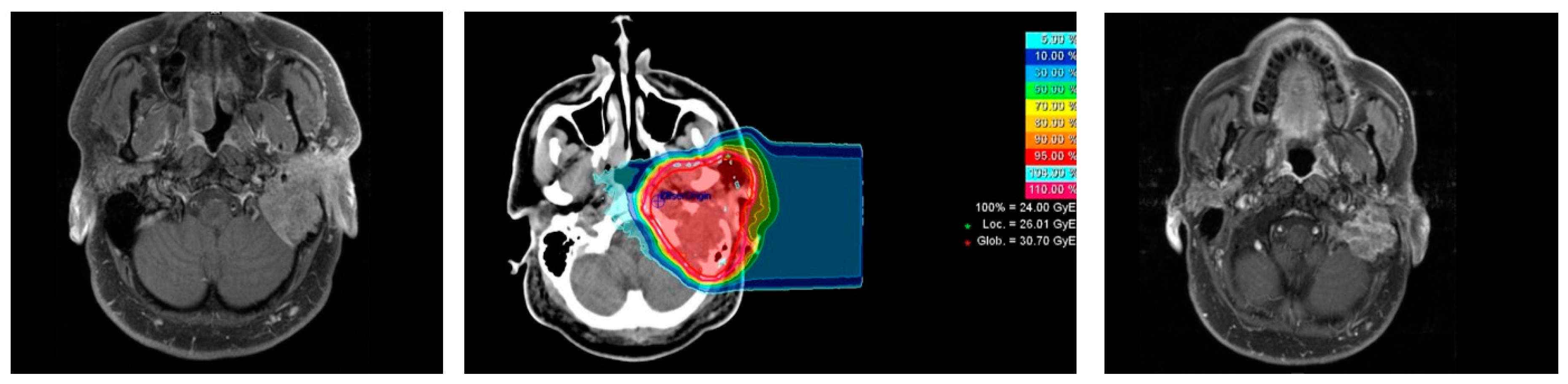 Cancers 13 00124 g001 Cancers 13 00124 g001