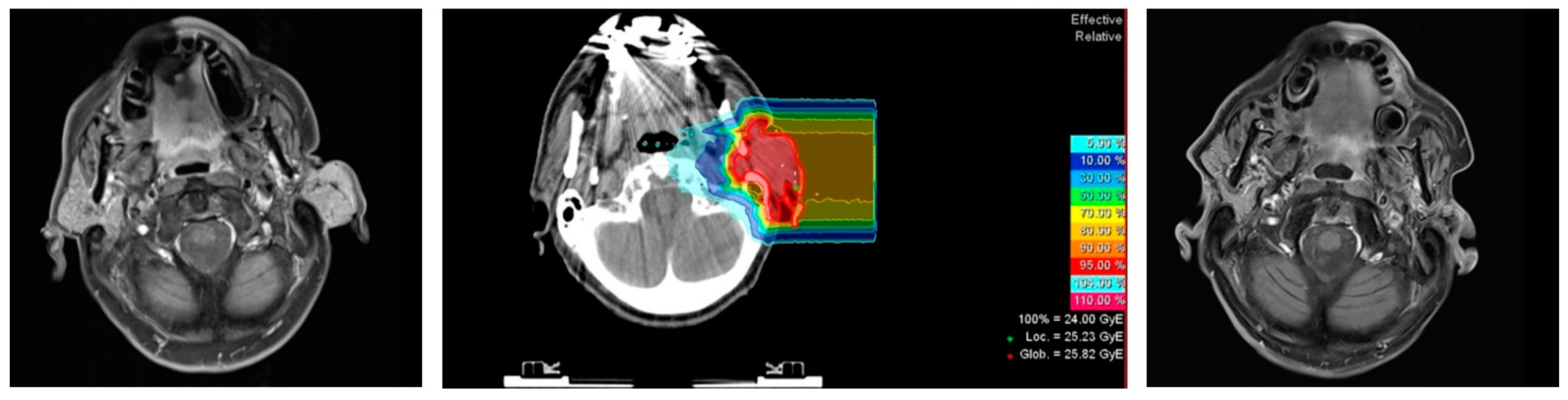 Cancers 13 00124 g002 Cancers 13 00124 g002