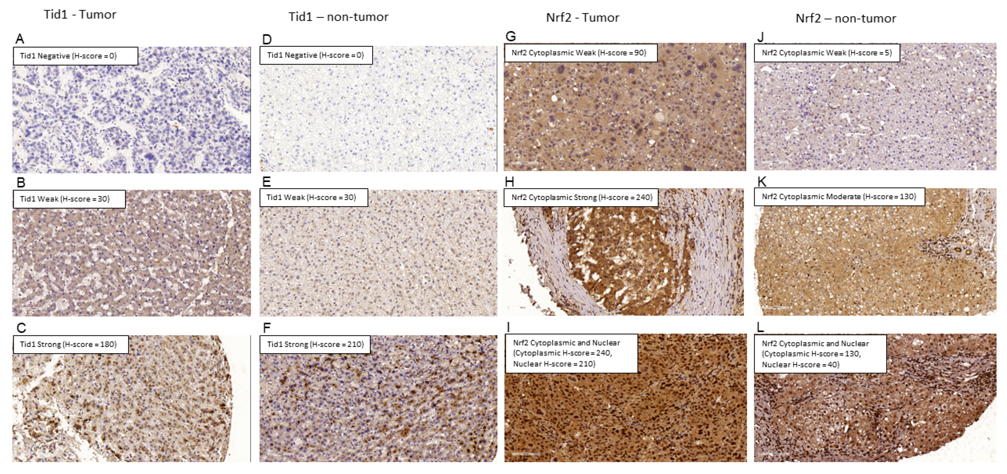 Cancers 13 00138 g005 Cancers 13 00138 g005