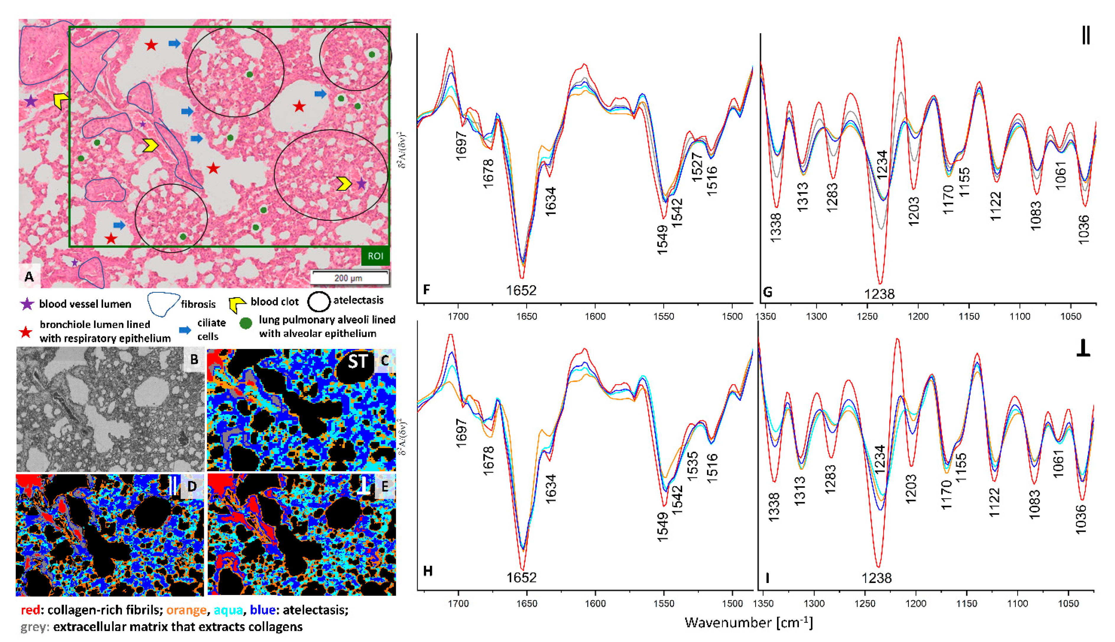 Cancers 13 00162 g002