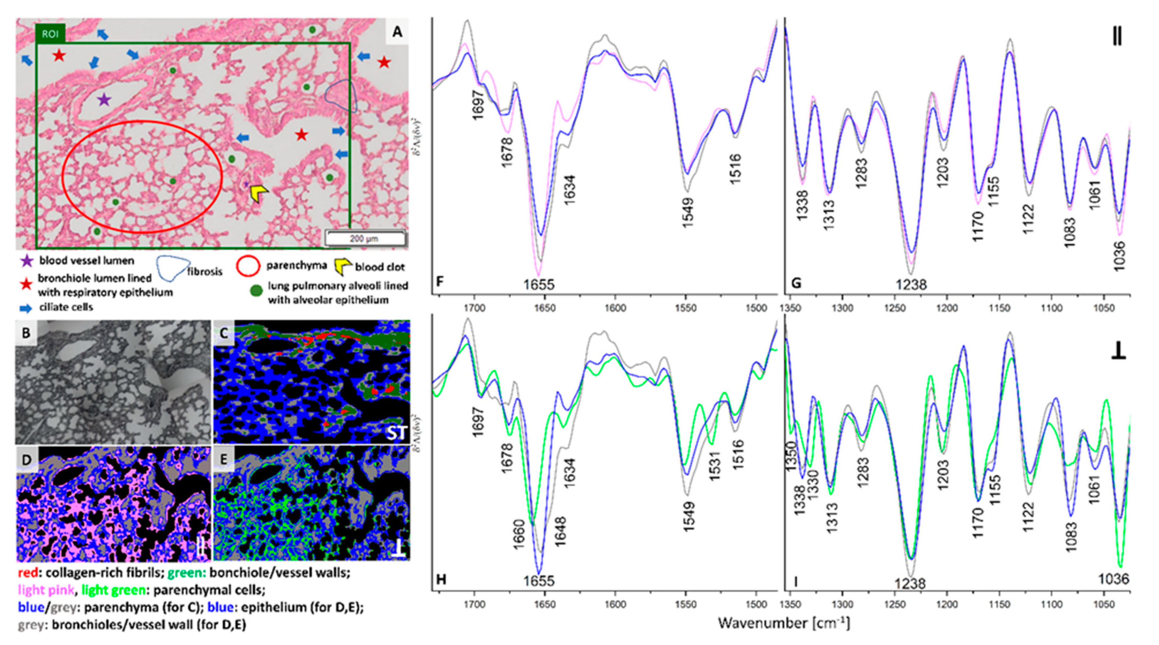 Cancers 13 00162 g003