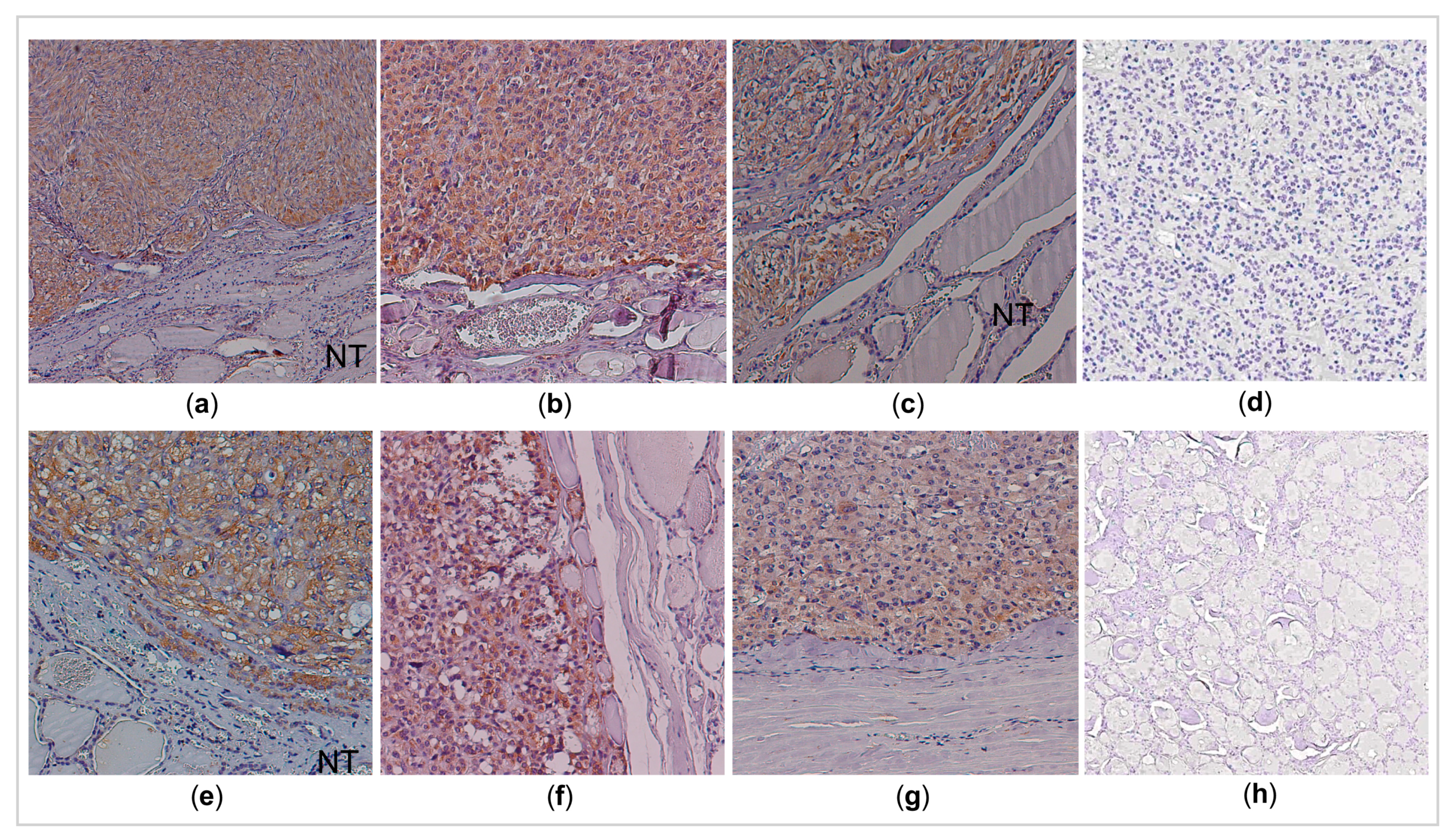 Cancers 13 00218 g003 Cancers 13 00218 g003