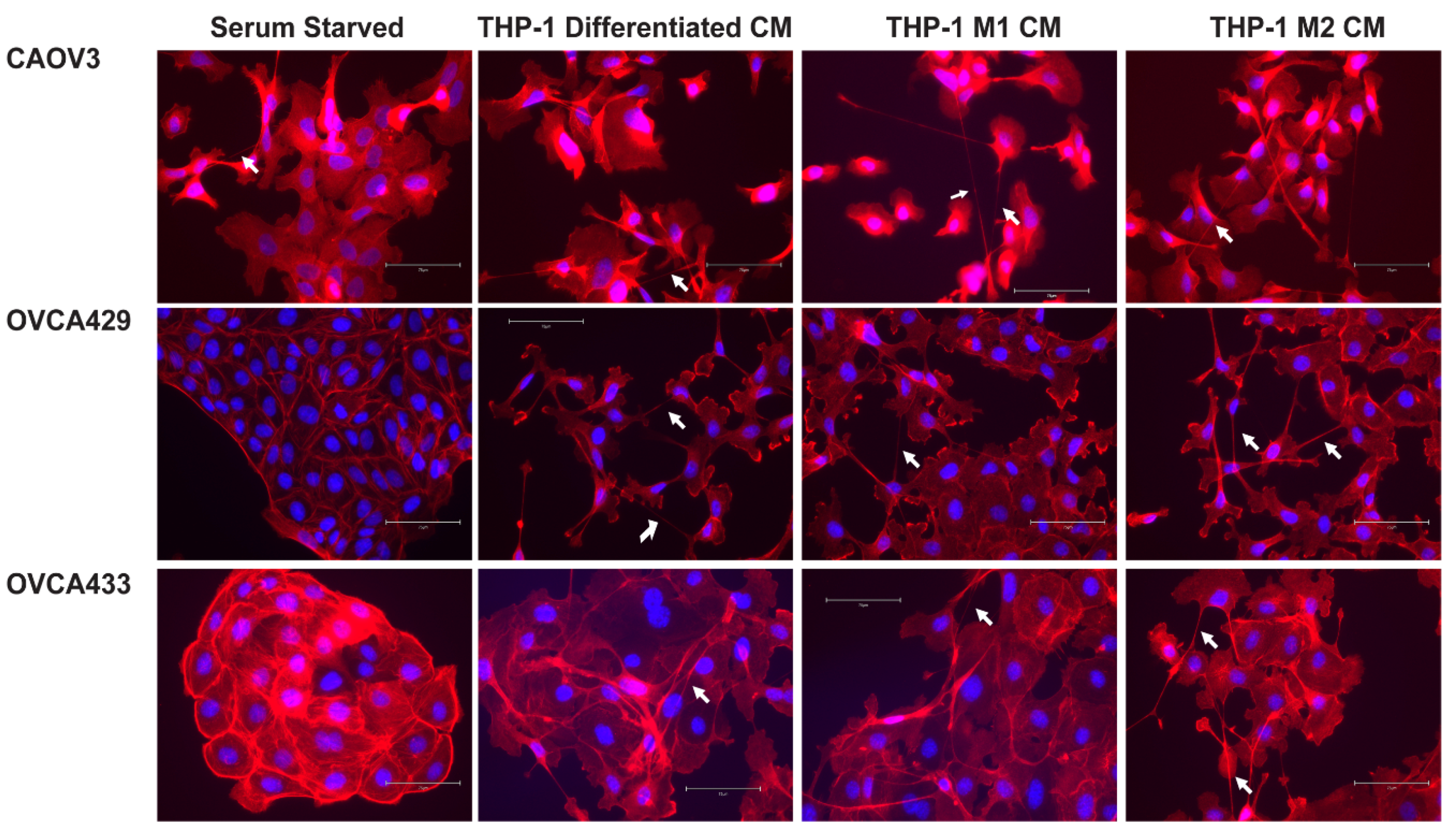 Cancers 13 00274 g003 Cancers 13 00274 g003
