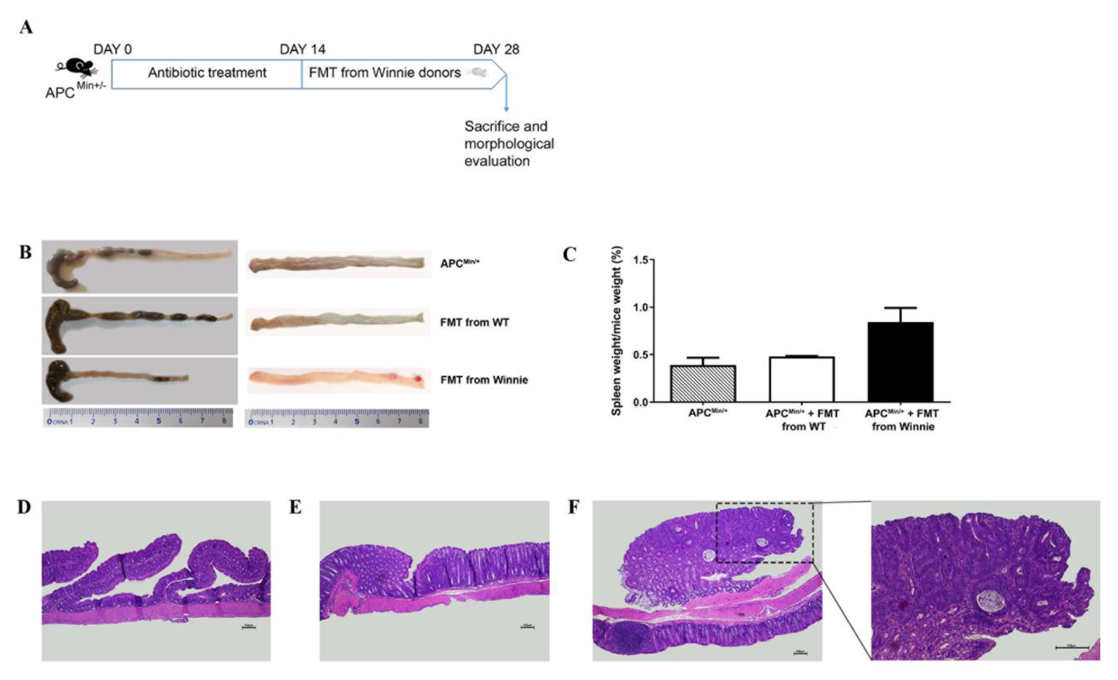 Cancers 13 00283 g005 Cancers 13 00283 g005