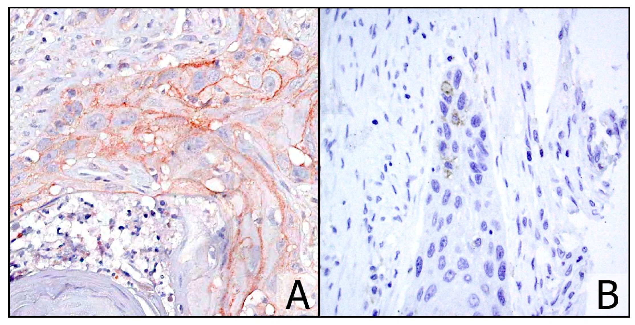 Cancers 13 00292 g002 Cancers 13 00292 g002