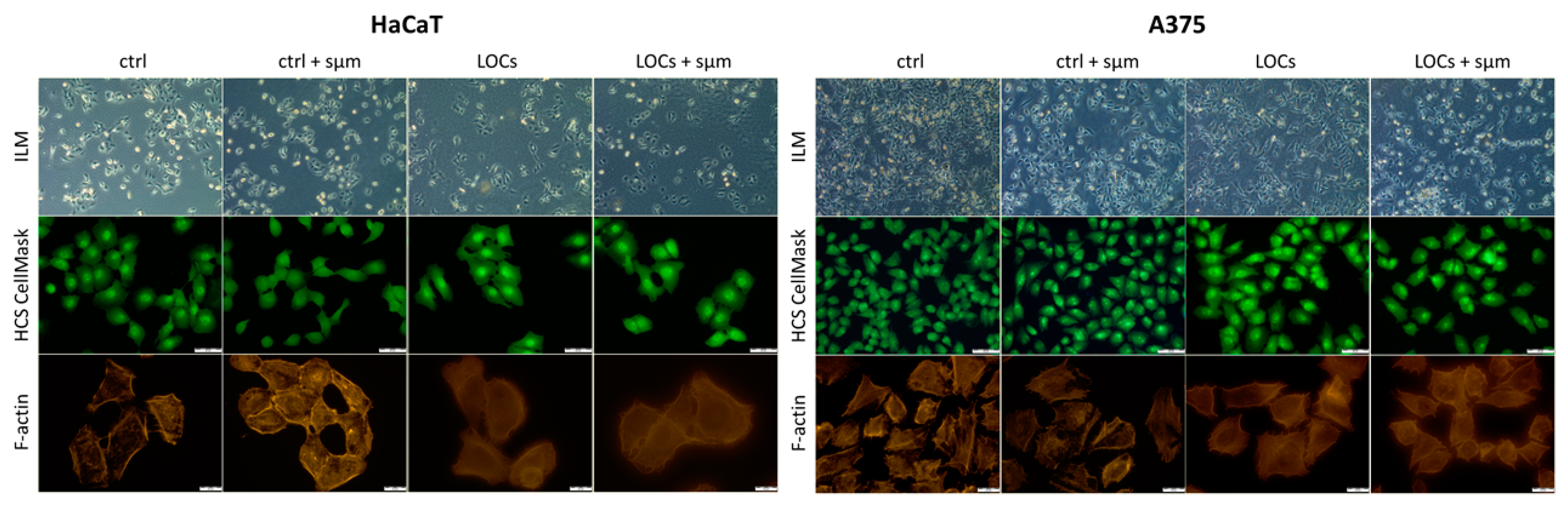 Cancers 13 00402 g005