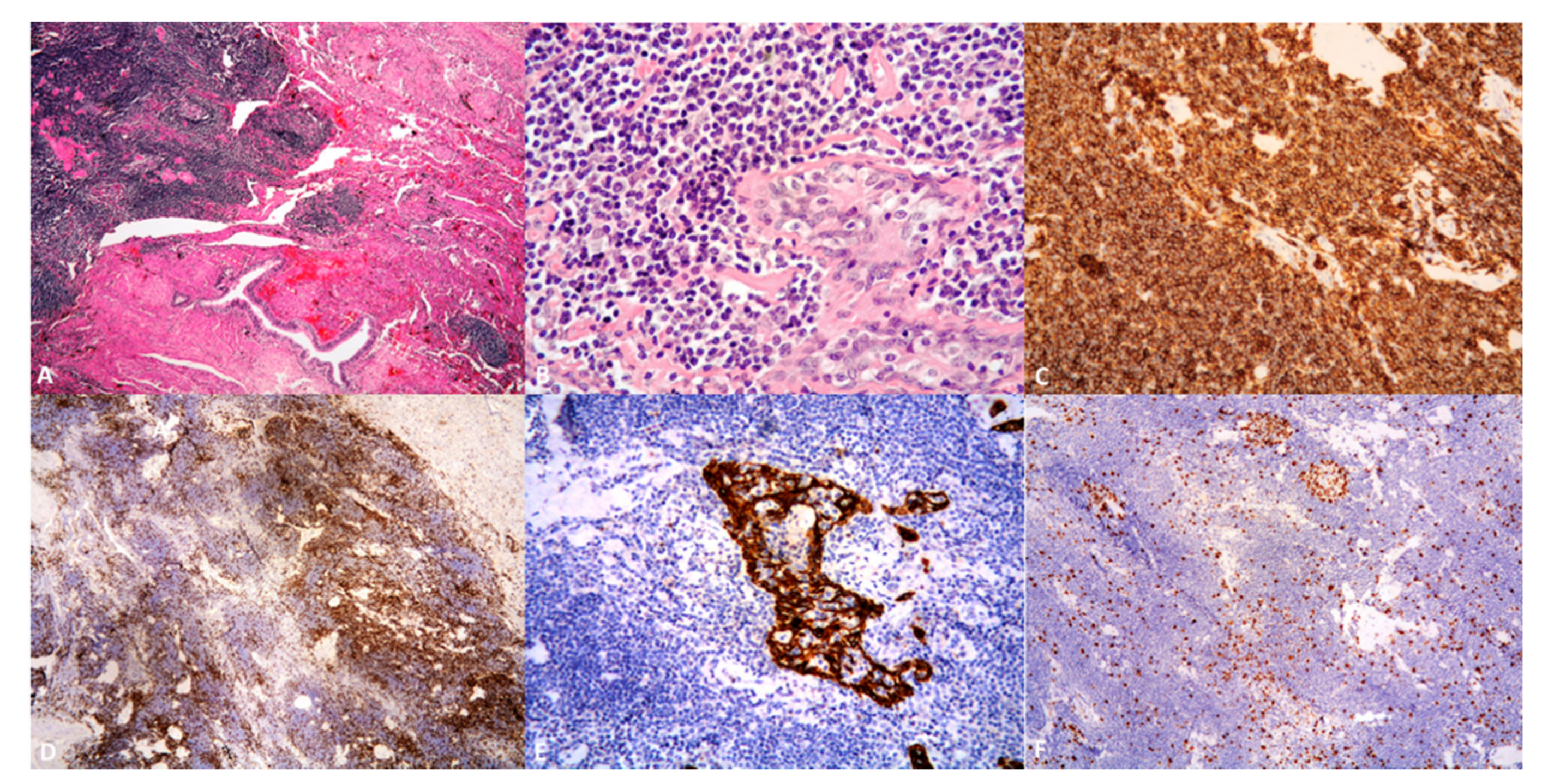 Cancers 13 00415 g002