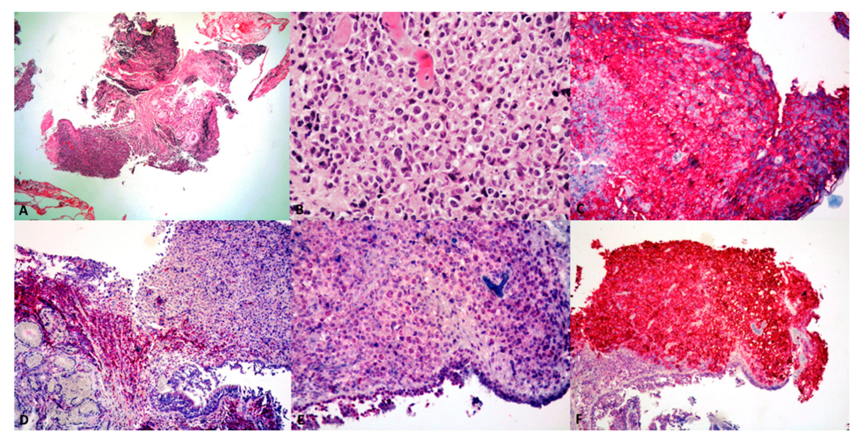 Cancers 13 00415 g003